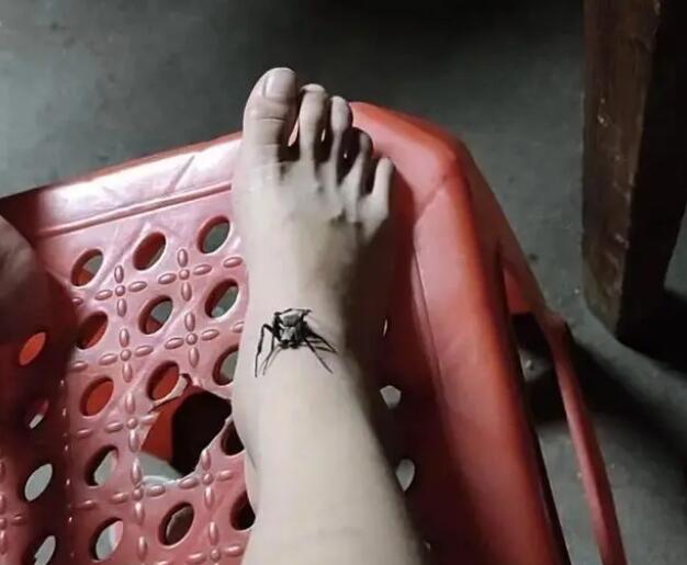 女孩被蛇咬傷奶奶抓蜘蛛吸毒 偏方害人不淺